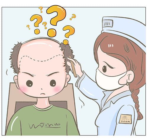 关于长沙亚韩植发的其他常见问题解答www.51aimei.com
