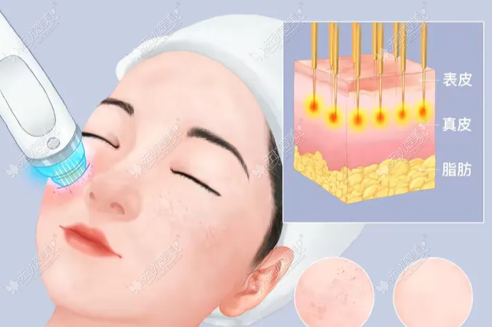 20260901160137583.png image.png