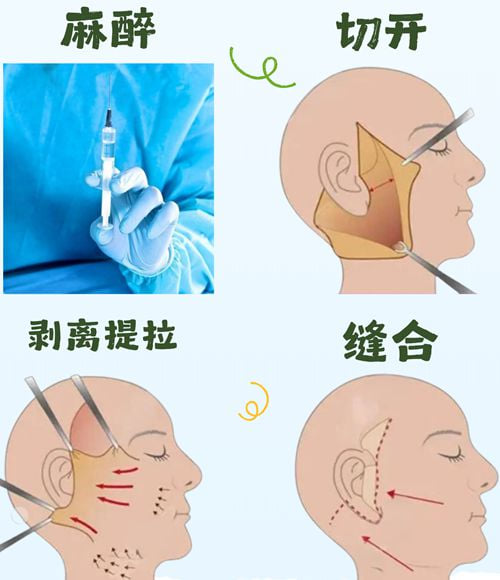 www.51aimei.com