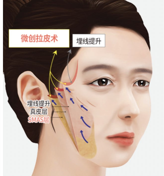 四、给你几个掏心窝子的建议