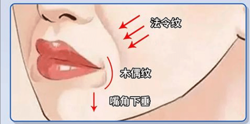 FAQ：关于福州名韩徐丽珍眼周口周年轻化预约常见问题