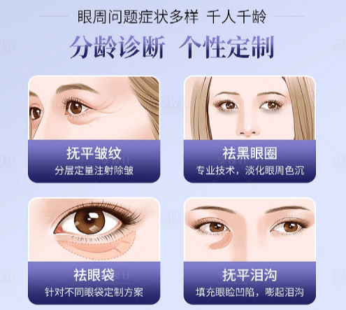 薛文静眼周黑绷带套餐谁适合做？谁不适合？先对号入座www.51aimei.com