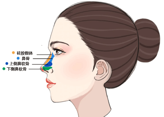五、香港鼻子微调价格怎么看?